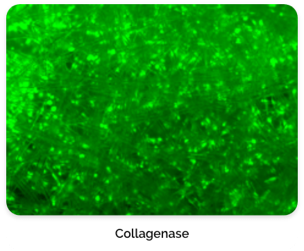 Collagenase